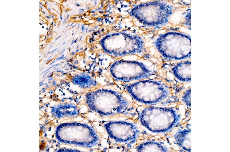 Immunohistochemistry - Anti-Collagen I Antibody (A329273) - Antibodies.com
