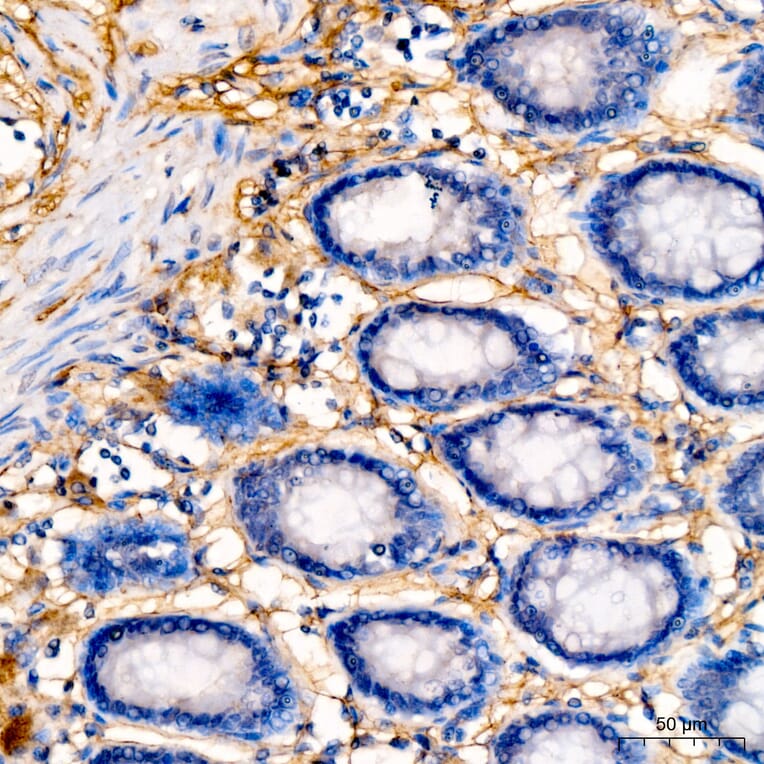 Immunohistochemistry - Anti-Collagen I Antibody (A329273) - Antibodies.com