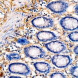 Immunohistochemistry - Anti-Collagen I Antibody (A329273) - Antibodies.com