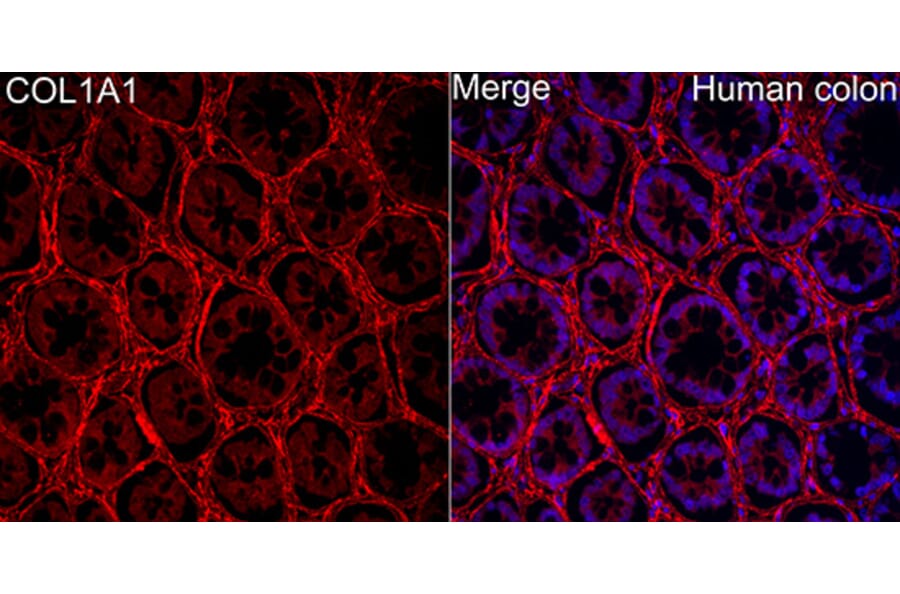 Immunofluorescence - Anti-Collagen I Antibody (A329273) - Antibodies.com