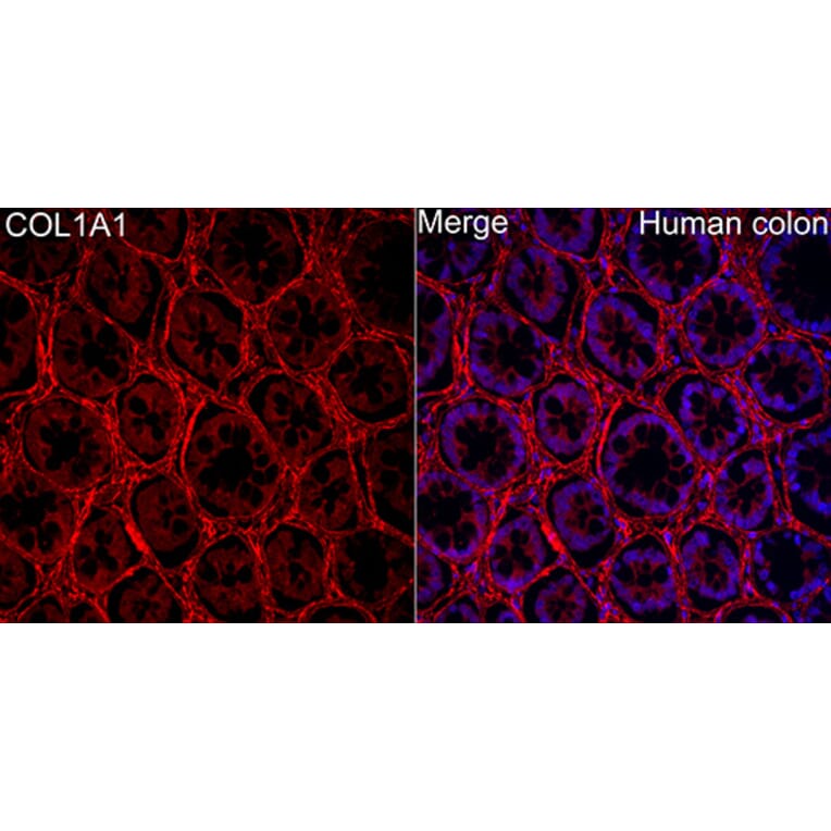 Immunofluorescence - Anti-Collagen I Antibody (A329273) - Antibodies.com