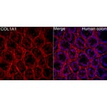 Immunofluorescence - Anti-Collagen I Antibody (A329273) - Antibodies.com
