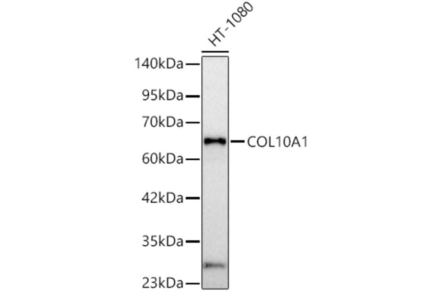 Western Blot - Anti-Collagen X Antibody (A329274) - Antibodies.com