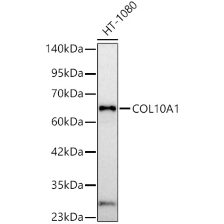 Western Blot - Anti-Collagen X Antibody (A329274) - Antibodies.com