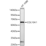 Western Blot - Anti-Collagen X Antibody (A329274) - Antibodies.com