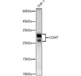 Western Blot - Anti-COMT Antibody (A329275) - Antibodies.com