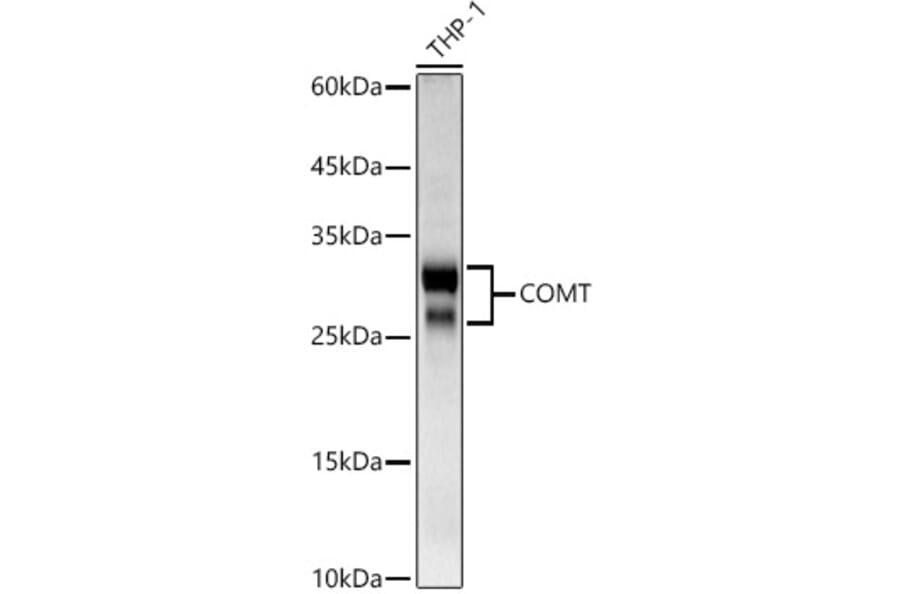 Western Blot - Anti-COMT Antibody (A329275) - Antibodies.com