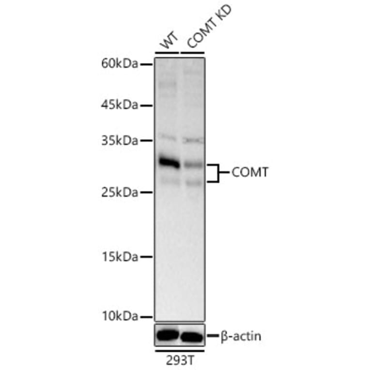 Western Blot - Anti-COMT Antibody (A329275) - Antibodies.com