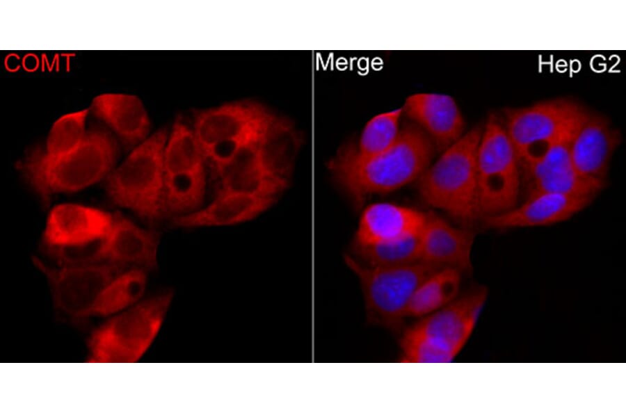 Immunofluorescence - Anti-COMT Antibody (A329275) - Antibodies.com
