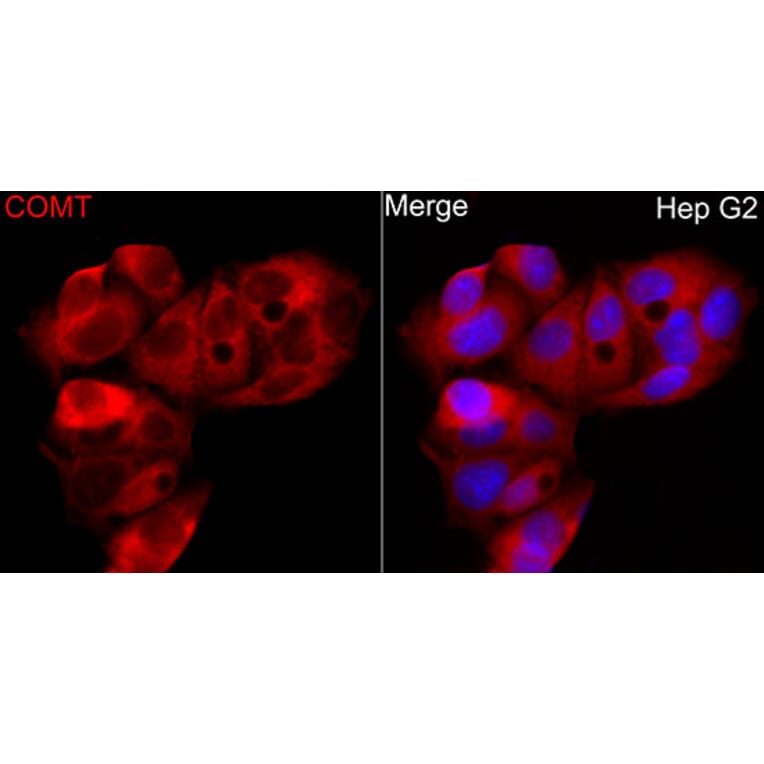 Immunofluorescence - Anti-COMT Antibody (A329275) - Antibodies.com