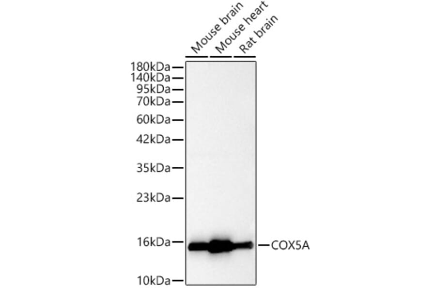 Western Blot - Anti-COX5A Antibody (A329278) - Antibodies.com