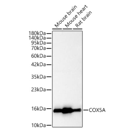 Western Blot - Anti-COX5A Antibody (A329278) - Antibodies.com