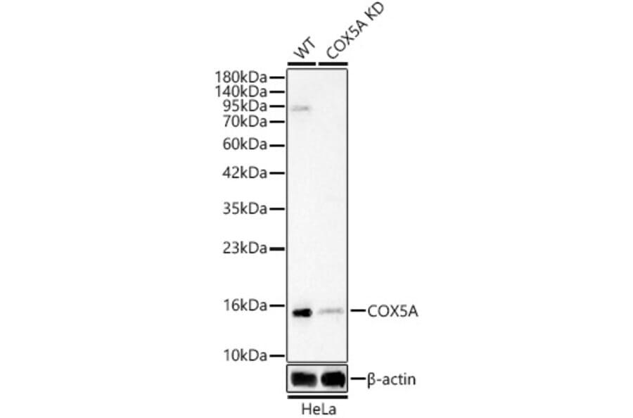 Western Blot - Anti-COX5A Antibody (A329278) - Antibodies.com
