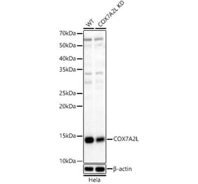 Western Blot - Anti-COX7A2L Antibody (A329279) - Antibodies.com