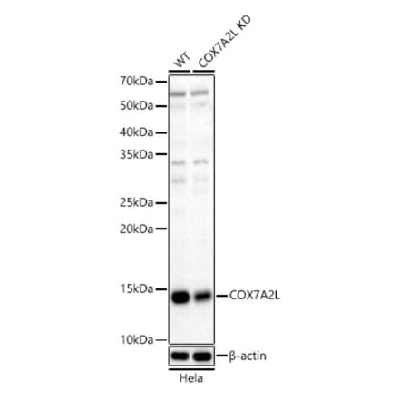 Western Blot - Anti-COX7A2L Antibody (A329279) - Antibodies.com