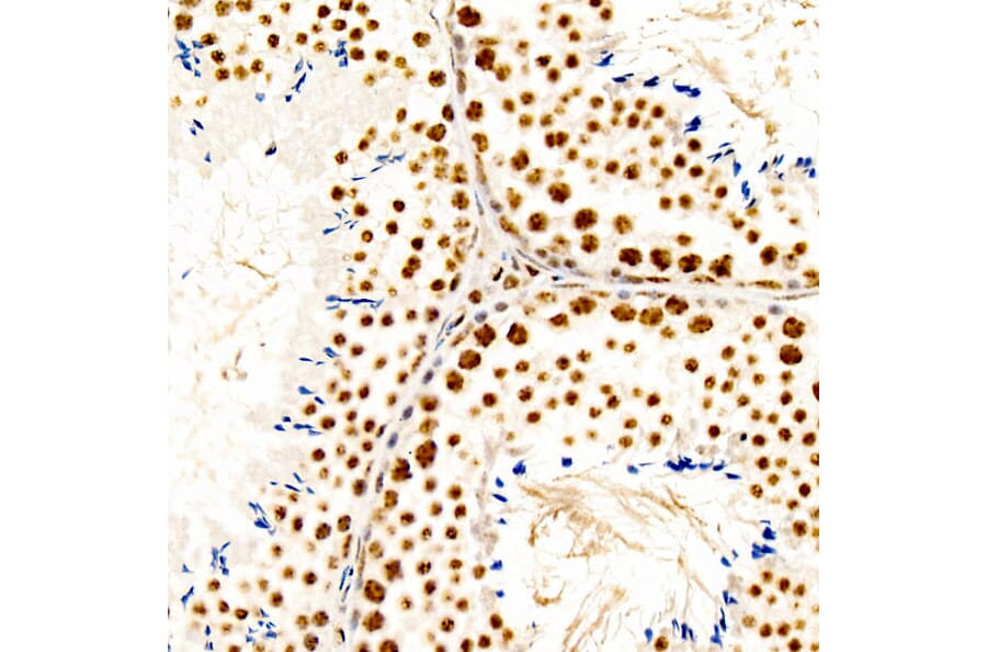 Immunohistochemistry - Anti-CREB (Phospho S133) Antibody [ARC60280] (A329280) - Antibodies.com