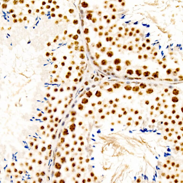 Immunohistochemistry - Anti-CREB (Phospho S133) Antibody [ARC60280] (A329280) - Antibodies.com
