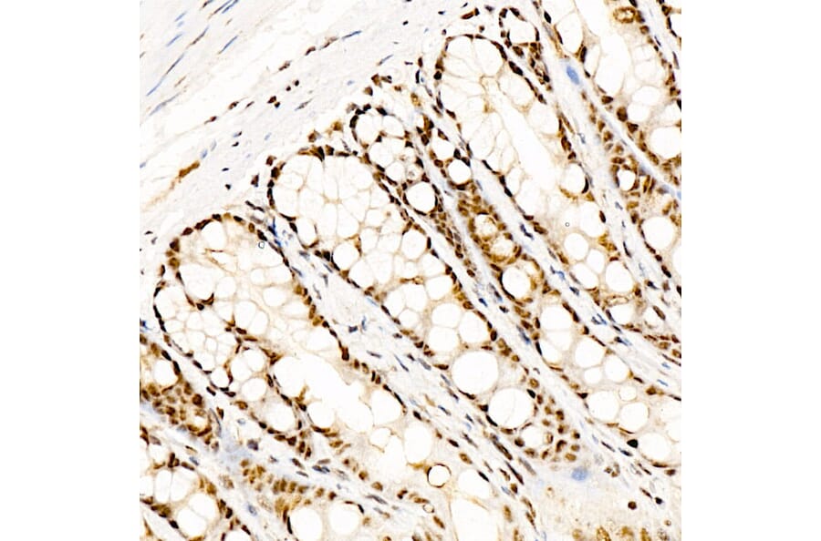 Immunohistochemistry - Anti-CREB (Phospho S133) Antibody [ARC60280] (A329280) - Antibodies.com