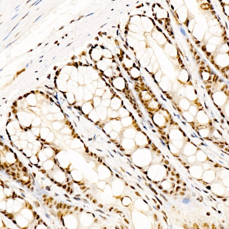 Immunohistochemistry - Anti-CREB (Phospho S133) Antibody [ARC60280] (A329280) - Antibodies.com