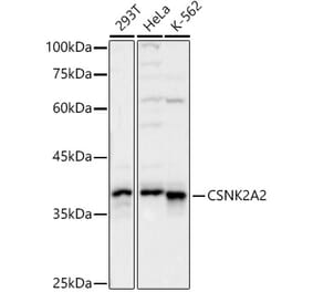 Western Blot - Anti-CSNK2A2 Antibody (A329283) - Antibodies.com