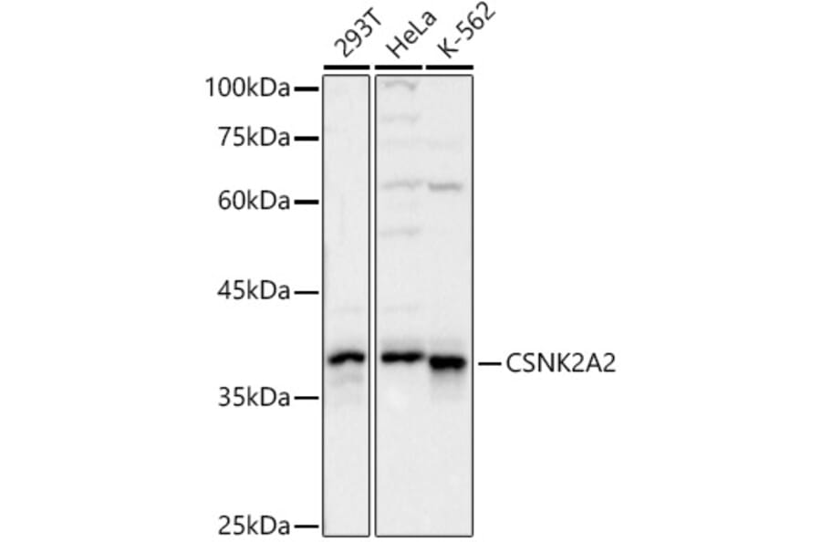 Western Blot - Anti-CSNK2A2 Antibody (A329283) - Antibodies.com