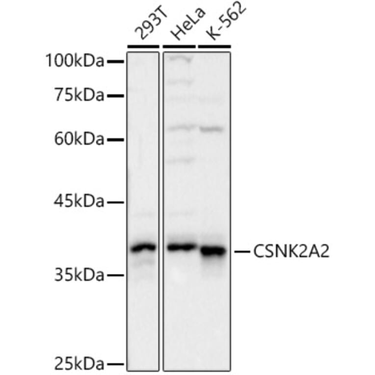 Western Blot - Anti-CSNK2A2 Antibody (A329283) - Antibodies.com