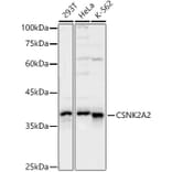 Western Blot - Anti-CSNK2A2 Antibody (A329283) - Antibodies.com