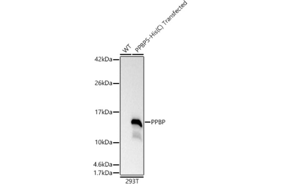 Western Blot - Anti-PBP Antibody (A329290) - Antibodies.com