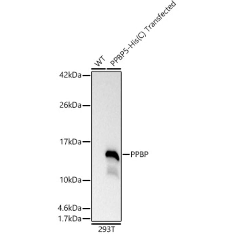 Western Blot - Anti-PBP Antibody (A329290) - Antibodies.com