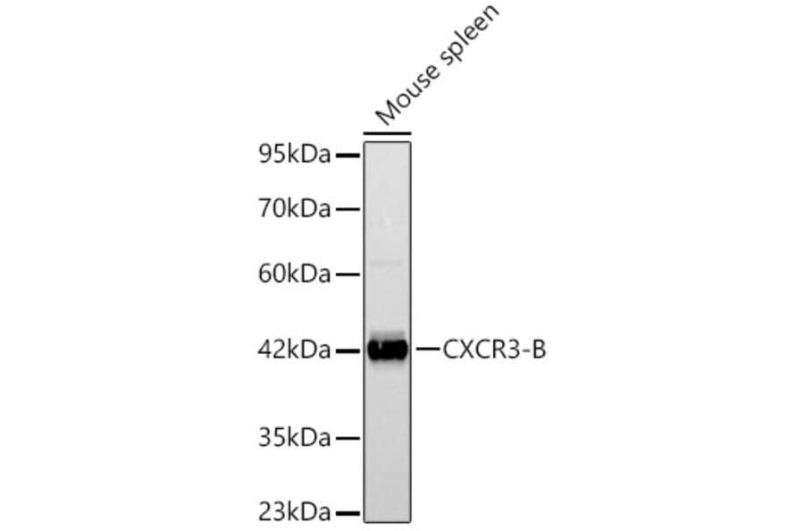 Western Blot - Anti-CXCR3 Antibody (A329292) - Antibodies.com