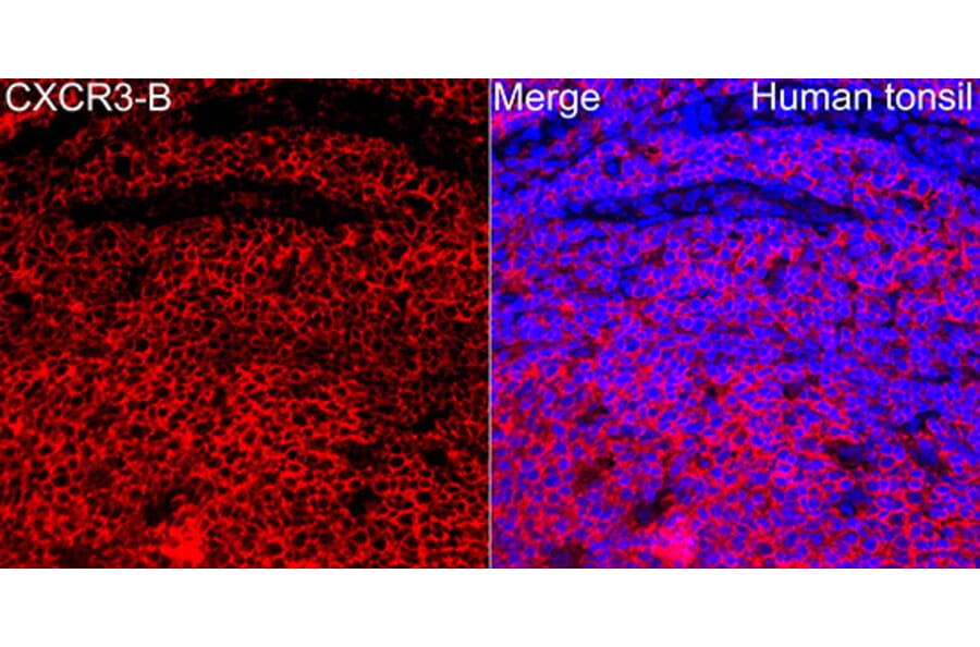 Immunofluorescence - Anti-CXCR3 Antibody (A329292) - Antibodies.com