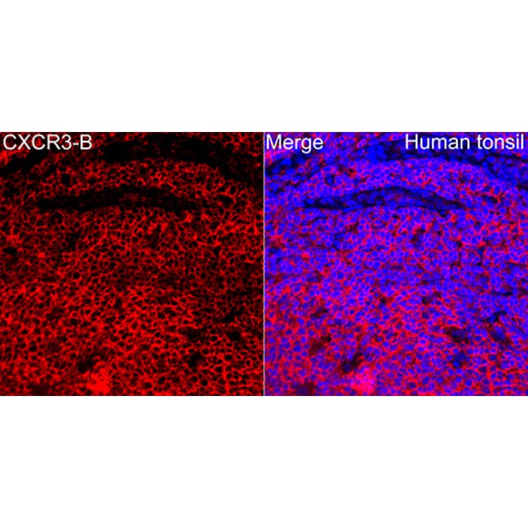 Immunofluorescence - Anti-CXCR3 Antibody (A329292) - Antibodies.com
