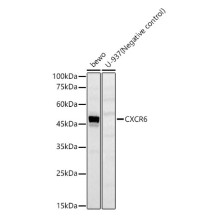 Western Blot - Anti-CXCR6 Antibody (A329293) - Antibodies.com