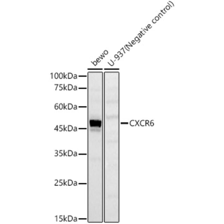 Western Blot - Anti-CXCR6 Antibody (A329293) - Antibodies.com