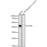 Western Blot - Anti-CXCR6 Antibody (A329293) - Antibodies.com