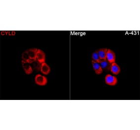 Immunofluorescence - Anti-CYLD Antibody (A329298) - Antibodies.com