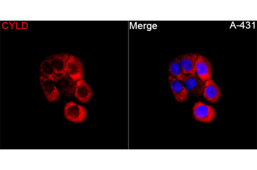 Immunofluorescence - Anti-CYLD Antibody (A329298) - Antibodies.com