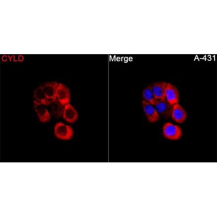 Immunofluorescence - Anti-CYLD Antibody (A329298) - Antibodies.com