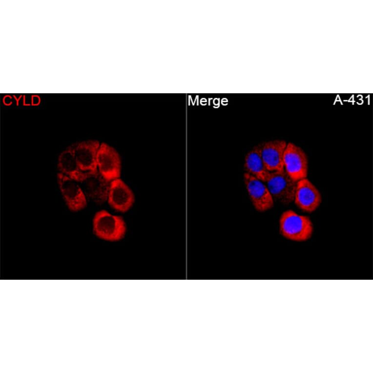 Immunofluorescence - Anti-CYLD Antibody (A329298) - Antibodies.com