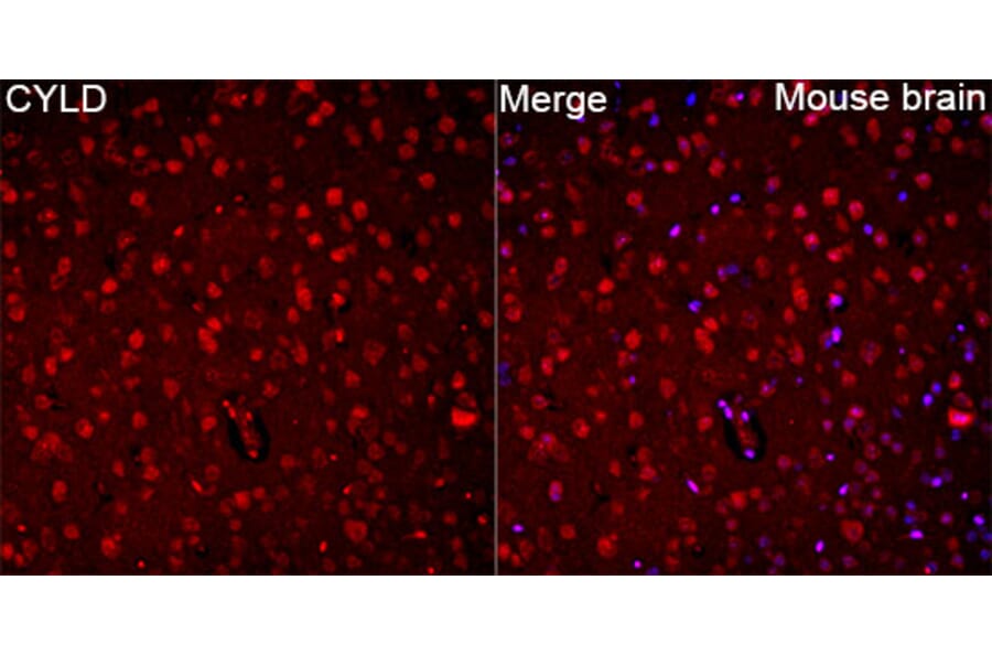 Immunofluorescence - Anti-CYLD Antibody (A329298) - Antibodies.com