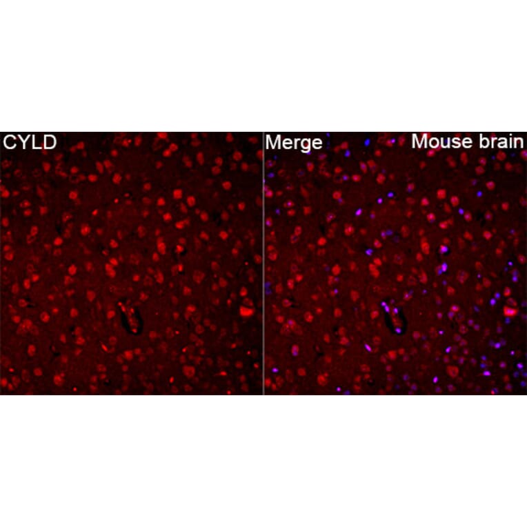 Immunofluorescence - Anti-CYLD Antibody (A329298) - Antibodies.com