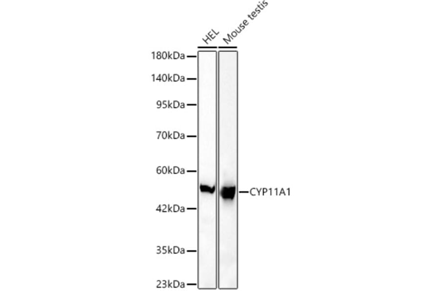 Western Blot - Anti-CYP11A1 Antibody [ARC61692] (A329299) - Antibodies.com