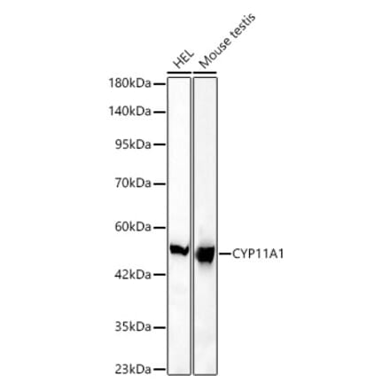 Western Blot - Anti-CYP11A1 Antibody [ARC61692] (A329299) - Antibodies.com