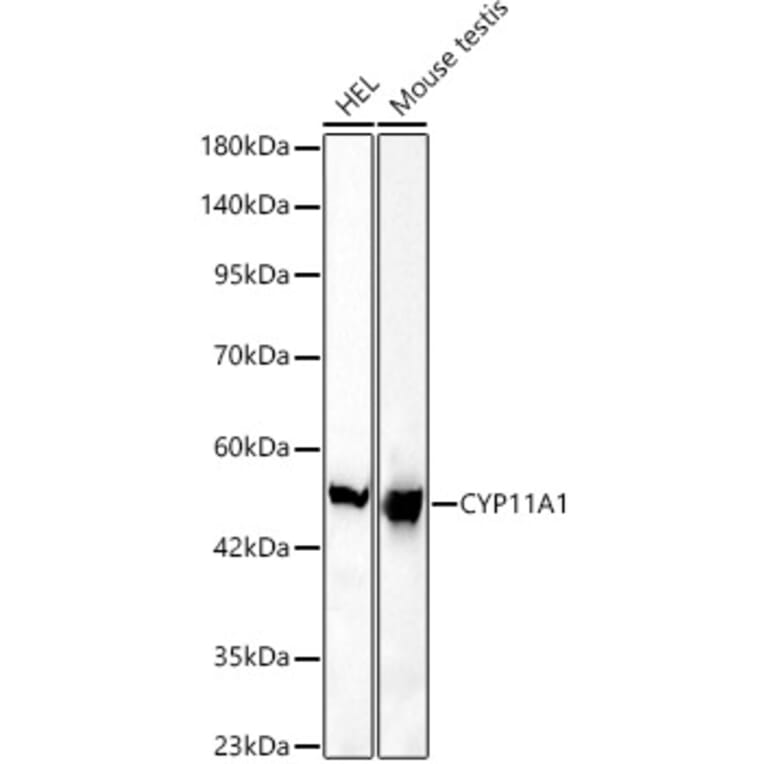 Western Blot - Anti-CYP11A1 Antibody [ARC61692] (A329299) - Antibodies.com