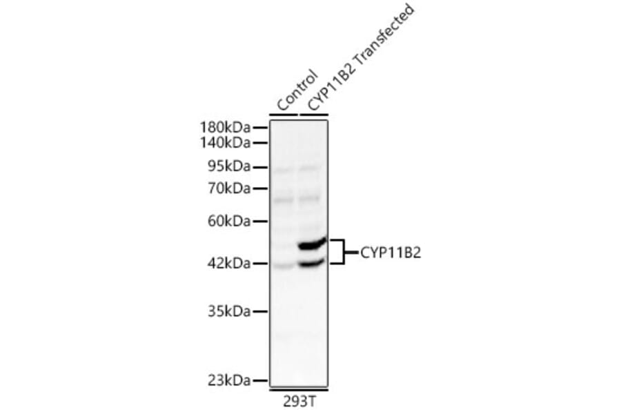 Western Blot - Anti-CYP11B2 Antibody (A329300) - Antibodies.com