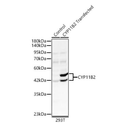 Western Blot - Anti-CYP11B2 Antibody (A329300) - Antibodies.com