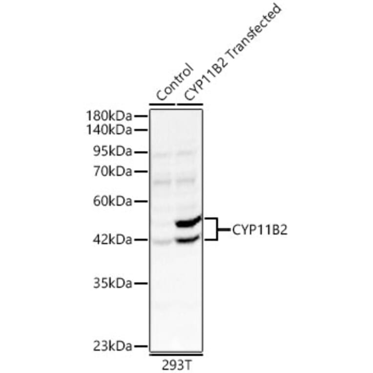 Western Blot - Anti-CYP11B2 Antibody (A329300) - Antibodies.com