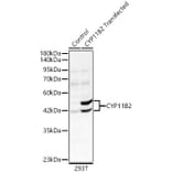 Western Blot - Anti-CYP11B2 Antibody (A329300) - Antibodies.com