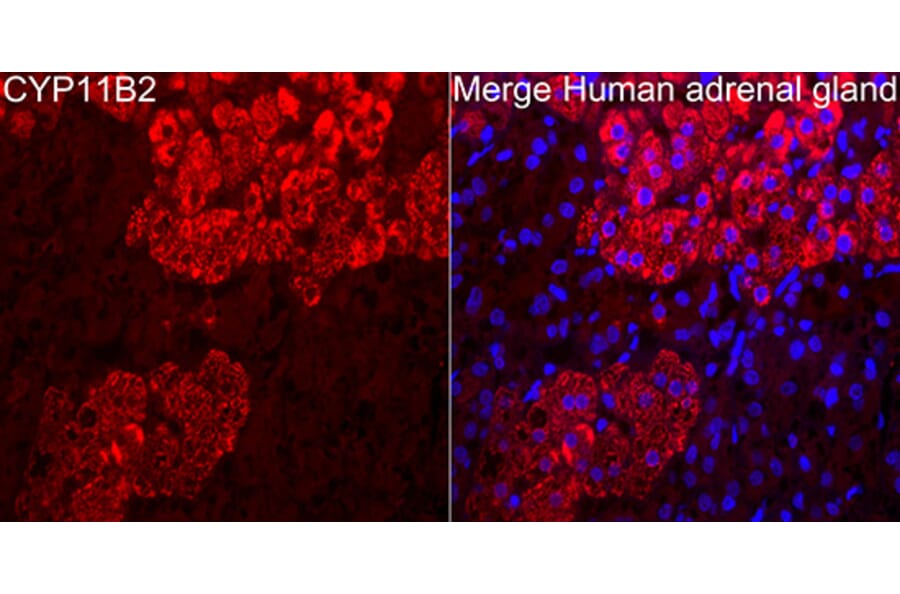 Immunofluorescence - Anti-CYP11B2 Antibody (A329300) - Antibodies.com