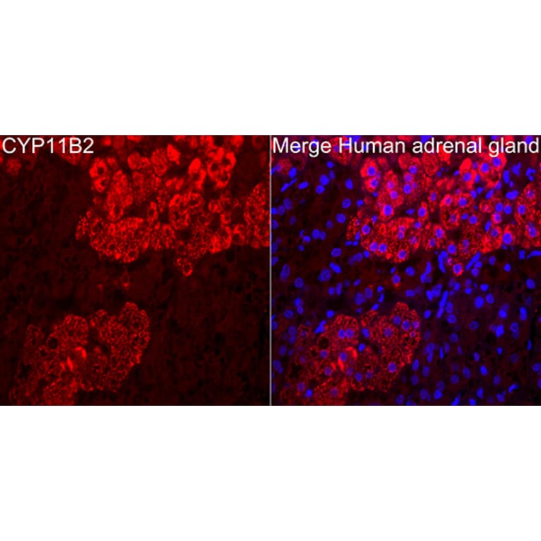 Immunofluorescence - Anti-CYP11B2 Antibody (A329300) - Antibodies.com